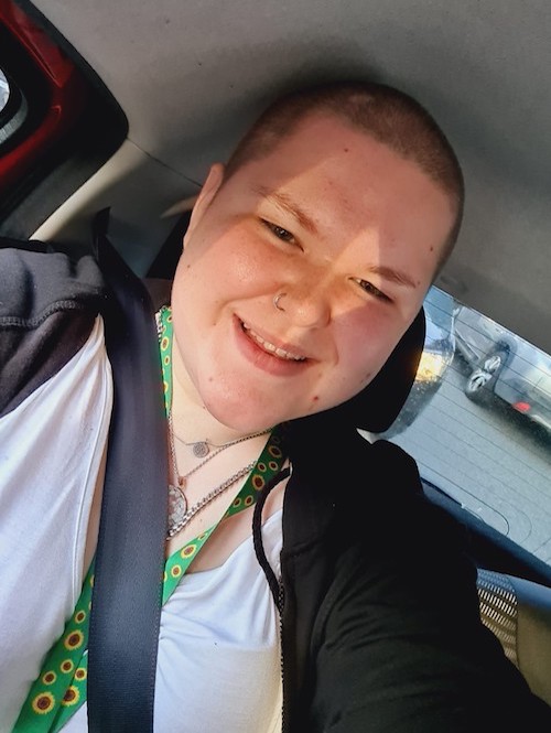 A selfie of Amy, an 18 year old female with a shaved head. She sits in a car with her Hidden Disabilities Sunflower lanyard on. 
